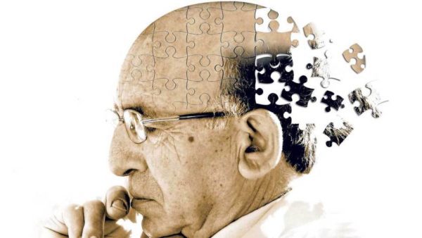 Alzheimer-disease-patients