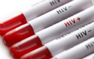 HIV - SIDA