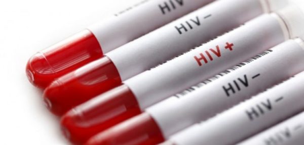Unas 78 mil personas son VIH positivo en RD