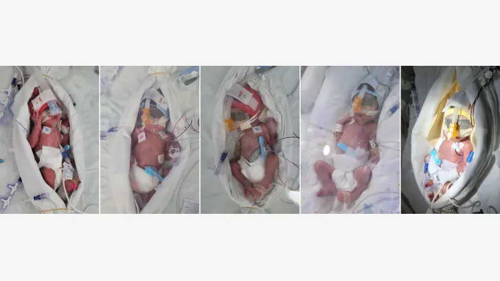  Imagen facilitada por el Hospital de la Universidad Nacional de Seúl de los quintillizos, cuatro niñas y un niño, nacidos a última hora del jueves. EFE/EPA/YONHAP / SEOUL NATIONAL UNIVERSITY / HANDOUT