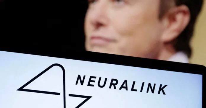 Autorizan a Neuralink para probar implantes cerebrales en humanos